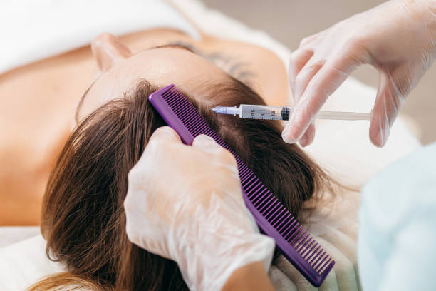 Hair transplantation in women